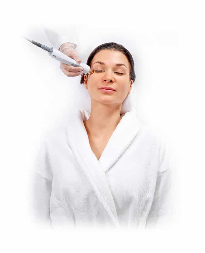 TempSure Envi device treatment image