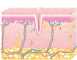 TempSure Envi skin treatment comparison image